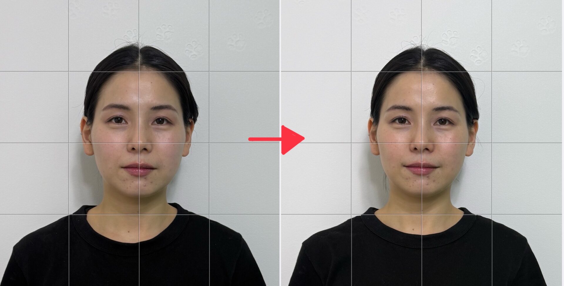 肌の変化には理由がある――テラヘルツ波とシリカが導くTOKIMEKIケアの実証