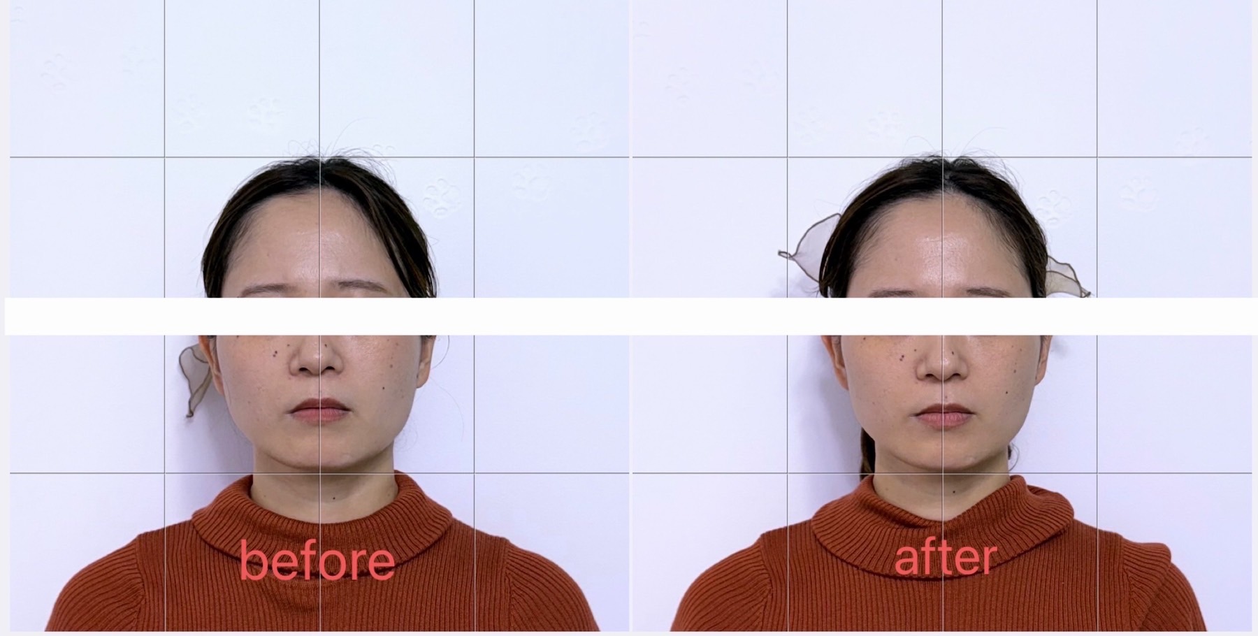 たった数分でもここまで変わる。トキメキケアのビフォーアフター