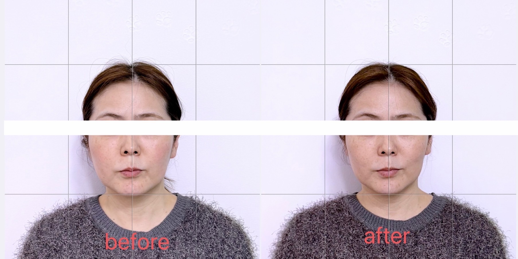 写真で伝わるトキメキケアの力。今回のビフォーアフターも驚きの変化です。